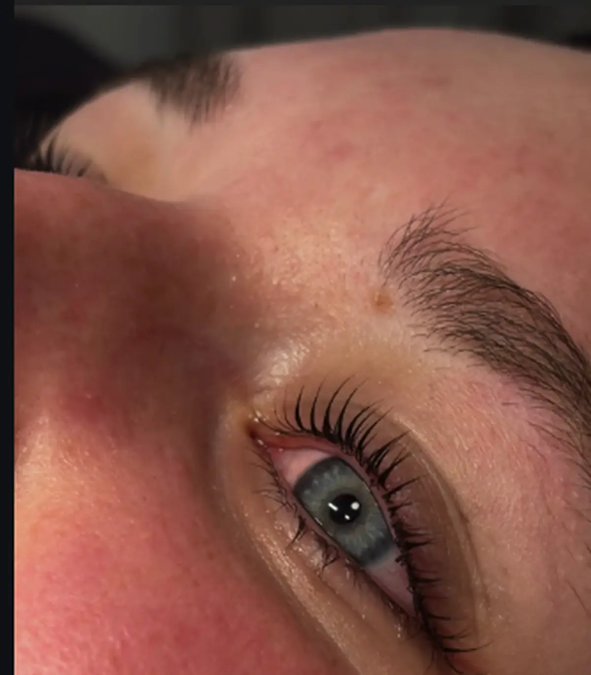 Wimpernlifting